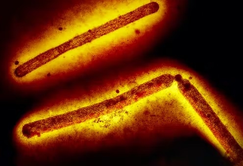 Bird flu FAQ: What is avian influenza? How is it transmitted to humans? What are the symptoms? Are there effective treatments and vaccines? Will H5N1 become the next viral pandemic? - Vimarsana News